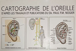 Cartographie de l'oreille